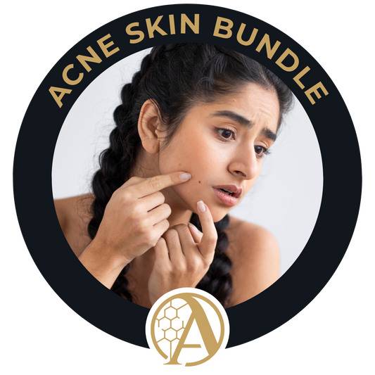 Acne Skin Bundle