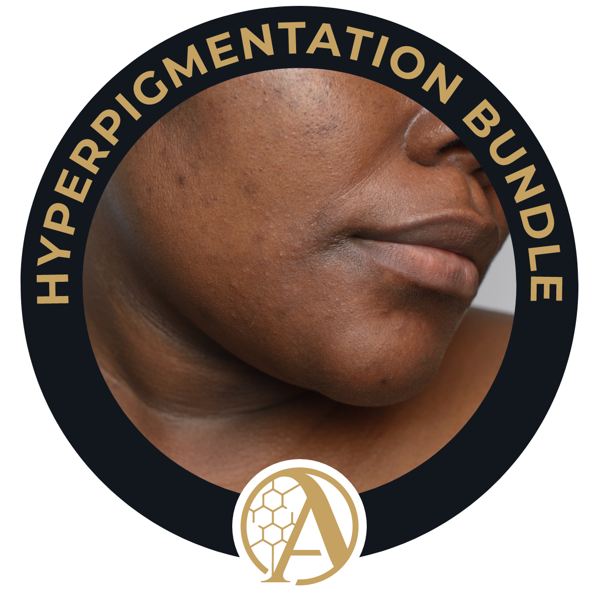 Hyperpigmentation Bundle